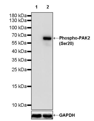 Phospho-PAK2 (Ser20) Recombinant Rabbit mAb (S-507-231)