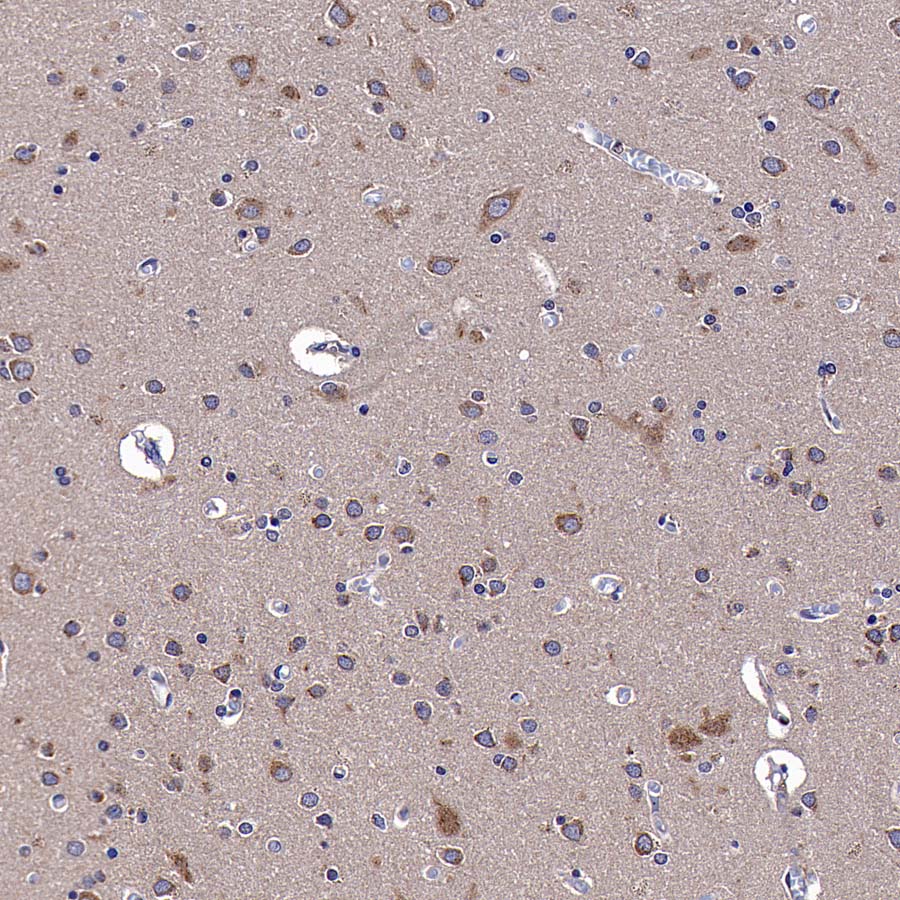 CGREF1 Recombinant Rabbit mAb (S-4558-25)
