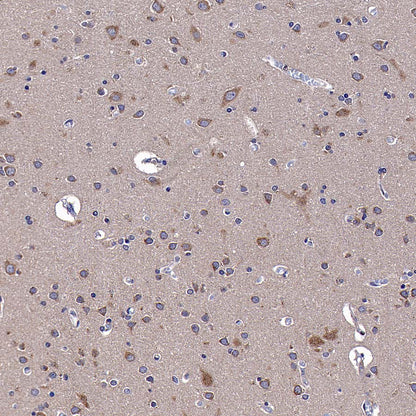 CGREF1 Recombinant Rabbit mAb (S-4558-25)