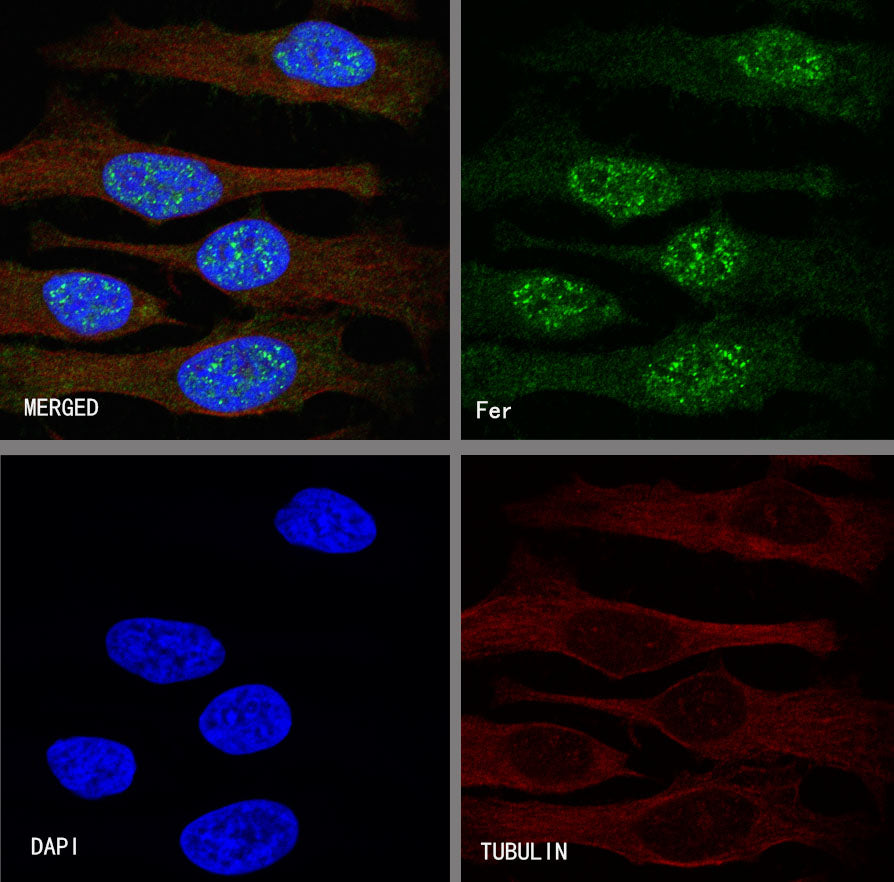 Fer Recombinant Rabbit mAb (S-R303)