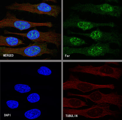 Fer Recombinant Rabbit mAb (S-R303)