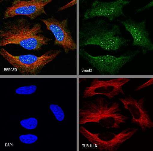 SMAD2 Recombinant Rabbit mAb (S-1420-20)