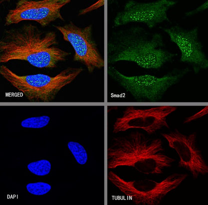 SMAD2 Recombinant Rabbit mAb (S-1420-20)
