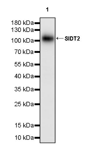 SIDT2 Recombinant Rabbit mAb (S-3763-76)