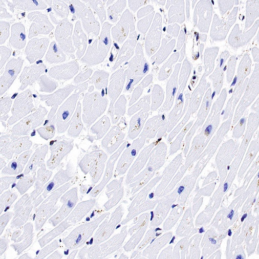 Calreticulin Recombinant Rabbit mAb (S-779-273)