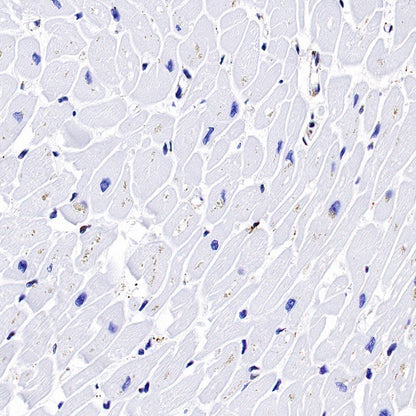 Calreticulin Recombinant Rabbit mAb (S-779-273)
