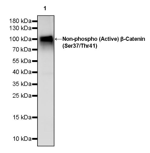 Non-phospho (Active) β-Catenin (Ser37/Thr41) Recombinant Rabbit mAb (S-1813-42)