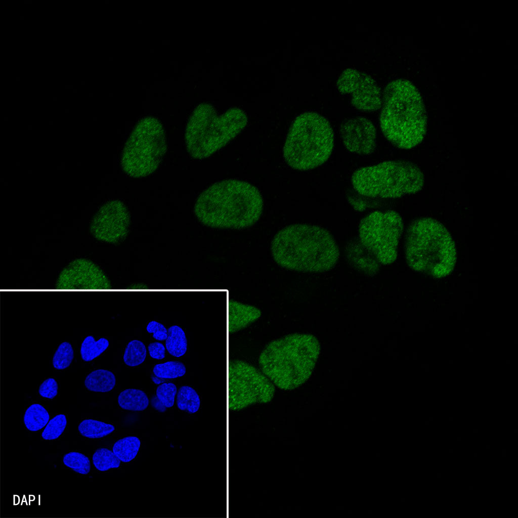 FOXA2 Recombinant Rabbit mAb (SDT-R174)