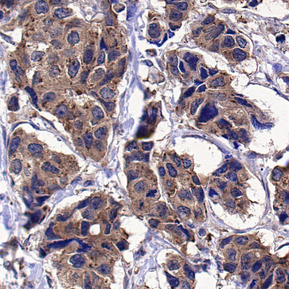 COPZ1 Recombinant Rabbit mAb (S-4445-53)