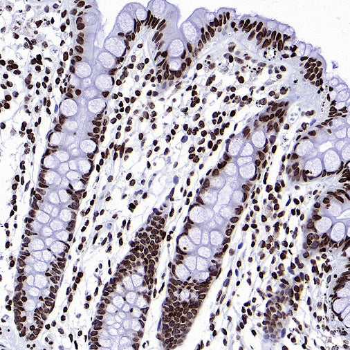 Histone H3 (di methyl K9) Recombinant Rabbit mAb (S-903-52)