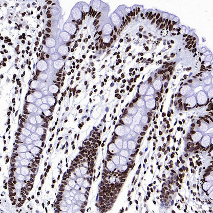 Histone H3 (di methyl K9) Recombinant Rabbit mAb (S-903-52)