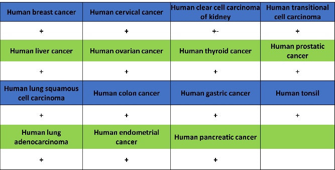 PI3 Kinase p85 beta Recombinant Rabbit mAb (S-1058-266)