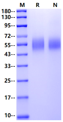 IL-13 R alpha 1 His Tag Protein, Human