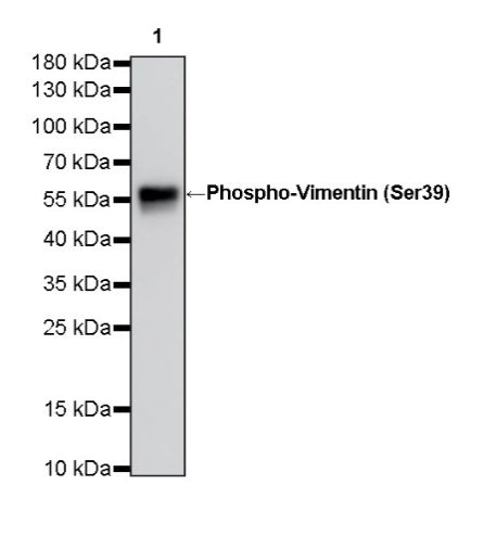 Phospho-Vimentin (Ser39) Rabbit Polyclonal Antibody
