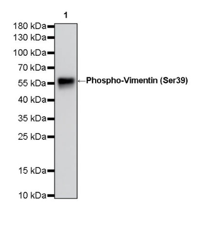 Phospho-Vimentin (Ser39) Rabbit Polyclonal Antibody