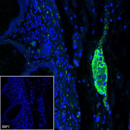 VIP Recombinant Rabbit mAb (S-1116-104)
