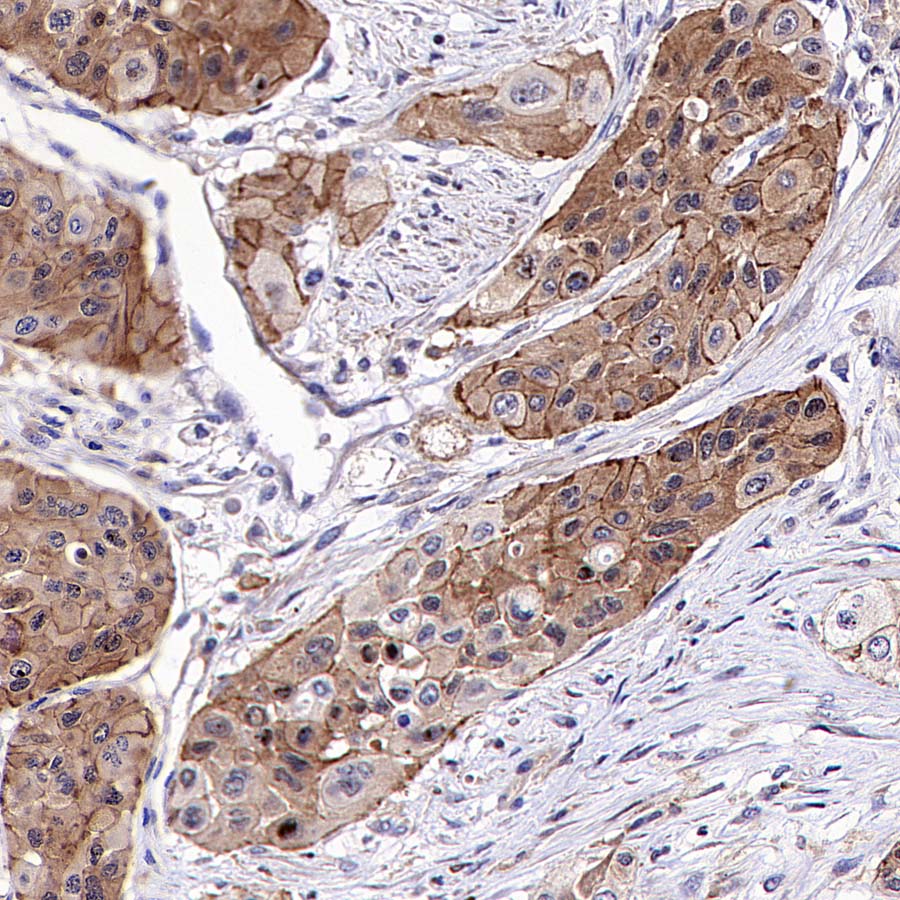 KLHL21 Recombinant Rabbit mAb (S-3460-252)
