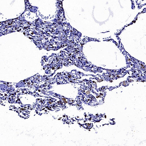 CD74 Recombinant Rabbit mAb (S-4524-58)