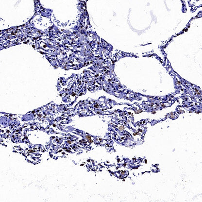 CD74 Recombinant Rabbit mAb (S-4524-58)