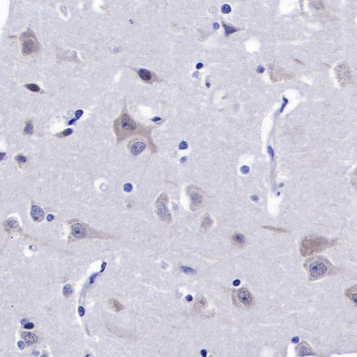 eIF3B Recombinant Rabbit mAb (S-816-8)