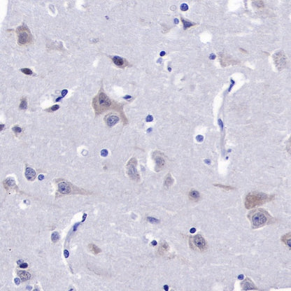 eIF3B Recombinant Rabbit mAb (S-816-8)