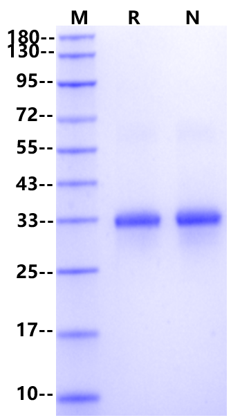 TRANCE/RANK L/TNFSF11 (245aa) Protein, Mouse