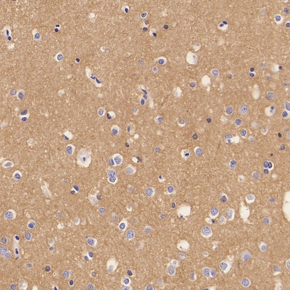 LICAM Recombinant Rabbit mAb, PBS Only (SDT-2594-39)