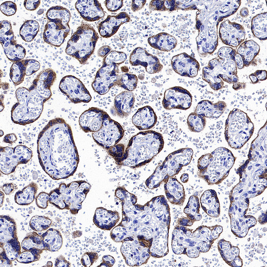 Glypican-3 Recombinant Rabbit mAb (SDT-4064-69)