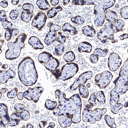 Glypican-3 Recombinant Rabbit mAb (SDT-4064-69)