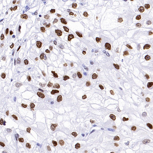 Phospho-Histone H2A.X (Ser139) Recombinant Rabbit mAb (S-1368-15)