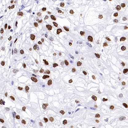 Phospho-Histone H2A.X (Ser139) Recombinant Rabbit mAb (S-1368-15)