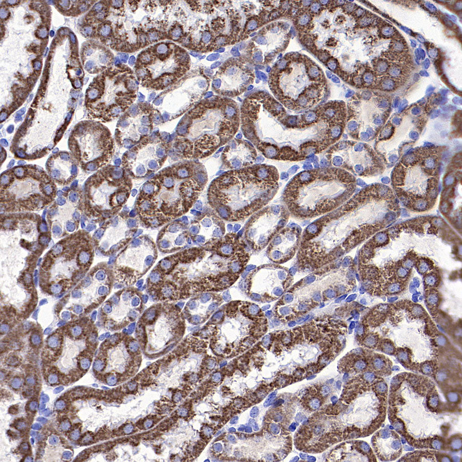 VDAC1 Recombinant Rabbit mAb (S-5314)