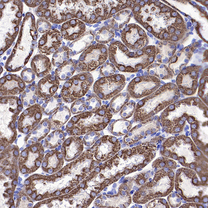 VDAC1 Recombinant Rabbit mAb (S-5314)