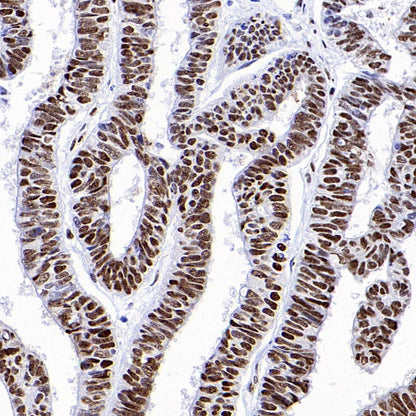 hnRNP H Rabbit Polyclonal Antibody