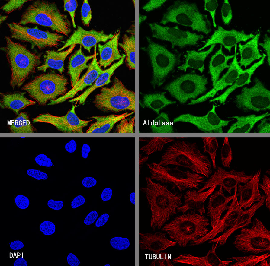 Aldolase A Recombinant Rabbit mAb (S-4007-23)