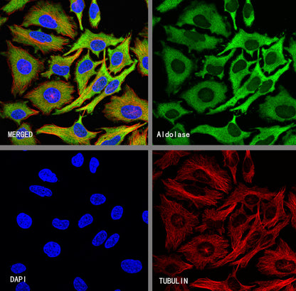 Aldolase A Recombinant Rabbit mAb (S-4007-23)