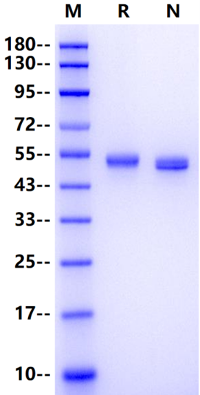 Carbonic Anhydrase IX/CA9 His Tag Protein, Human