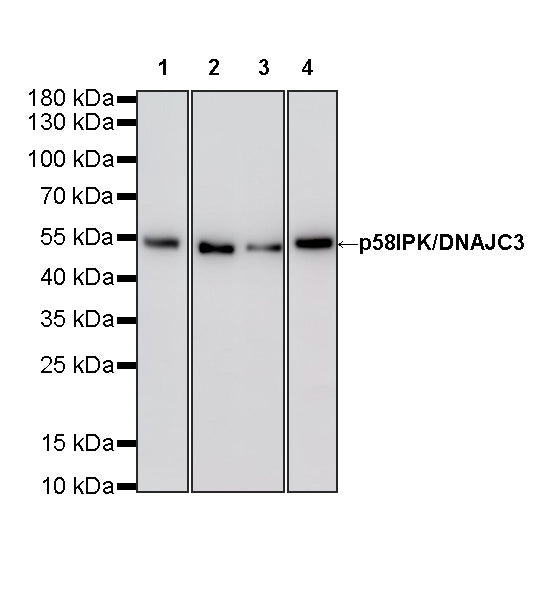p58IPK/DNAJC3 Recombinant Rabbit mAb (S-4816-205)