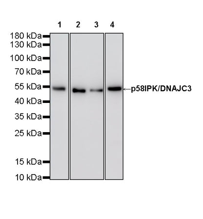 p58IPK/DNAJC3 Recombinant Rabbit mAb (S-4816-205)