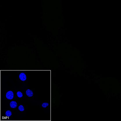 Mouse mAb IgM, κ Isotype Control (S-844-28)