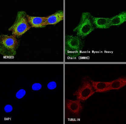 Smooth Muscle Myosin Heavy Chain (SMMHC) Recombinant Rabbit mAb (SDT-R089)