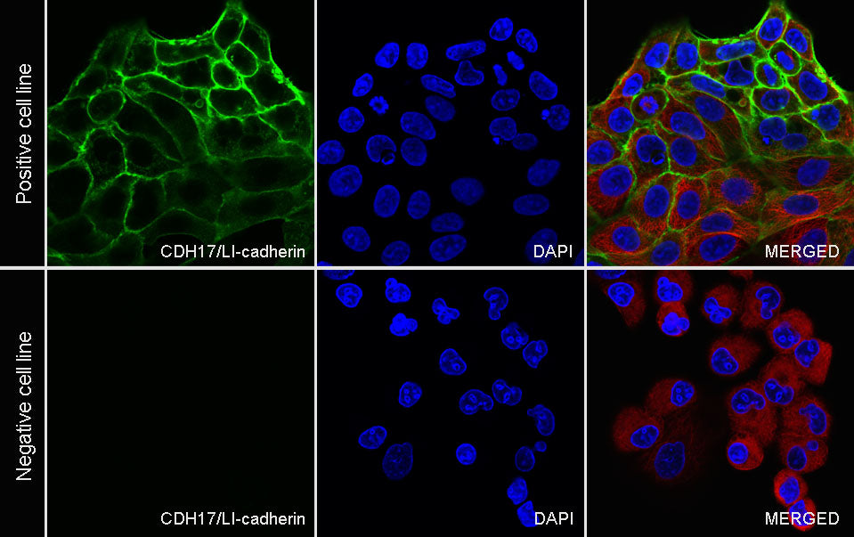 CDH17 Recombinant Rabbit mAb (SDT-3276-46)