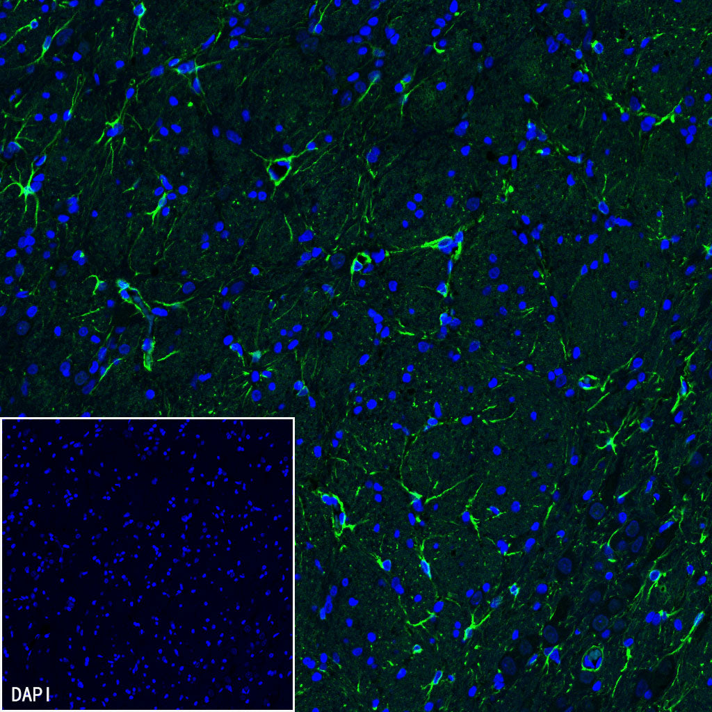 GFAP Recombinant Rabbit mAb (SDT-306-10)