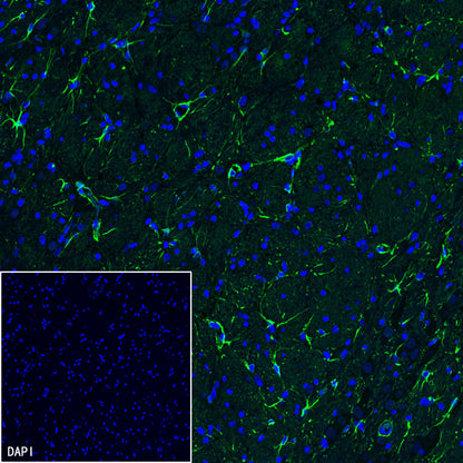 GFAP Recombinant Rabbit mAb (SDT-306-10)