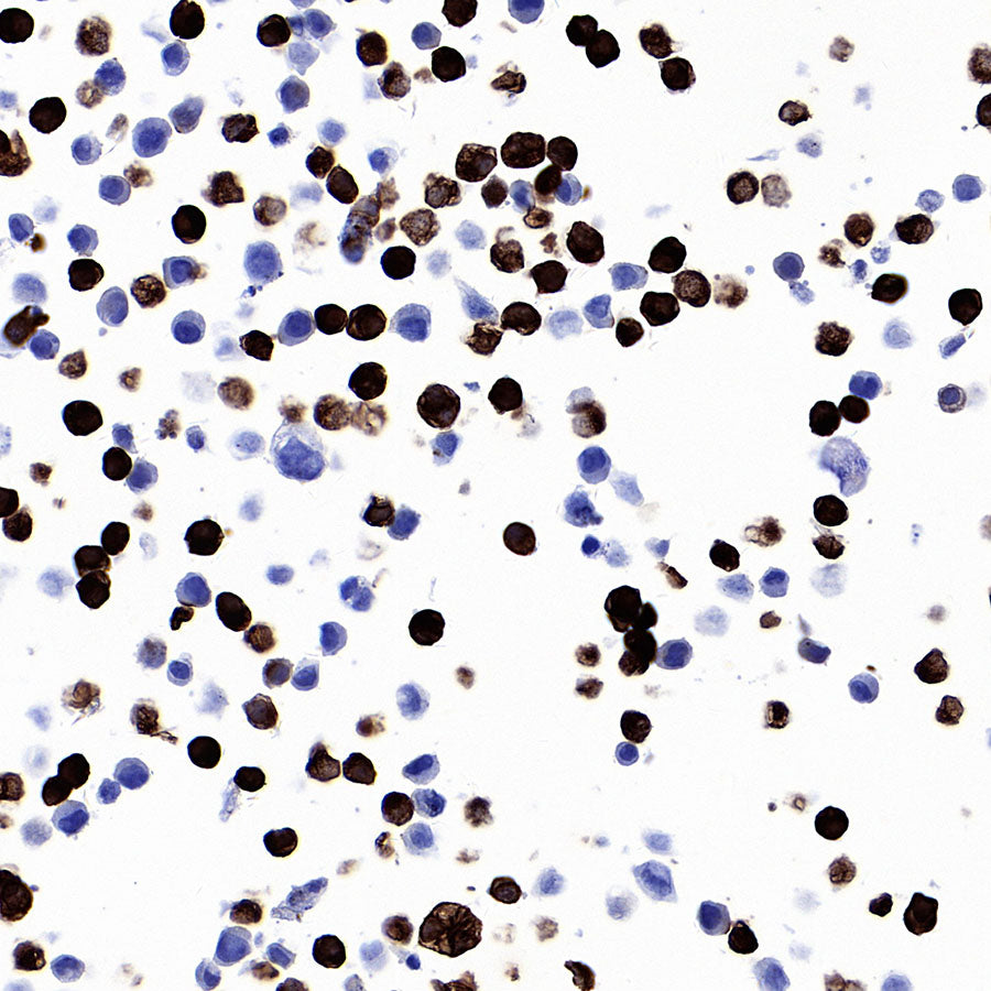 STEAP1+STEAP1B1+STEAP1B2 Recombinant Rabbit mAb (S-3226-137)