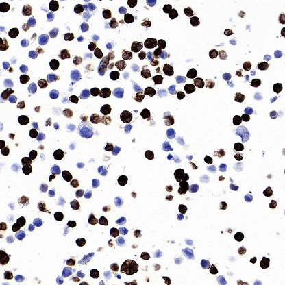 STEAP1+STEAP1B1+STEAP1B2 Recombinant Rabbit mAb (S-3226-137)