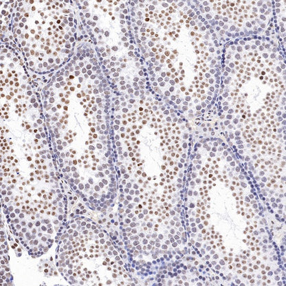 Histone H3 (mono methyl K79) Recombinant Rabbit mAb (S-R417)
