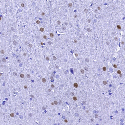 EGR2 Recombinant Rabbit mAb (S-741-136)