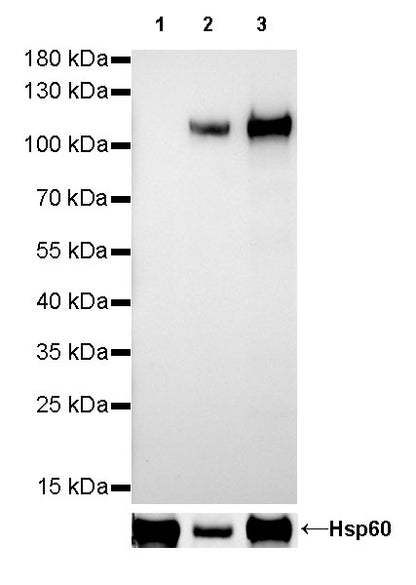 alpha-actinin-2 Recombinant Rabbit mAb (SDT-032-79)