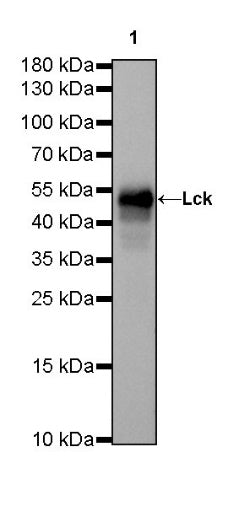 Lck Recombinant Rabbit mAb (SDT-316-15)